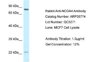 WB Suggested Anti-NCOA4 Antibody   Titration: 1. (NCOA4 抗体  (C-Term))