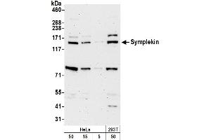 anti-Symplekin (SYMPK) (AA 350-400) antibody