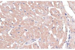 Immunohistochemistry of paraffin-embedded Mouse heart using COL11A1 Polyclonal Antibody at dilution of 1:100 (40x lens). (COL11A1 抗体)