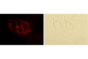 Expression of Angiotensin II Receptor Type-1 in rat C6 glioma cells - Cell surface detection of Angiotensin II Receptor Type-1 in live intact rat C6 glioma cells with Anti-Angiotensin II Receptor Type-1 (extracellular)-ATTO Fluor-550 Antibody (ABIN7042923), (1:50), (left panel).