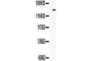 Western Blotting (WB) image for anti-Fms-Related tyrosine Kinase 1 (VEGFR1) (FLT1) (AA 278-298), (N-Term) antibody (ABIN3042978) (FLT1 抗体  (N-Term))