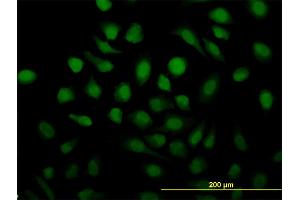 Immunofluorescence of monoclonal antibody to RAD51C on HeLa cell. (RAD51C 抗体  (AA 1-134))