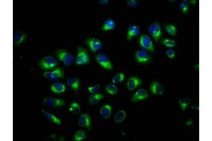 Immunofluorescence staining of Hela cells with ABIN7173590 at 1:100, counter-stained with DAPI. (FAM115C 抗体  (AA 472-590))