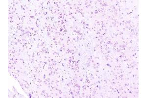 IHC analysis of RPS3 using anti-RPS3 antibody (ABIN6719371).