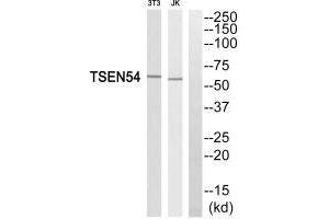 Western blot analysis of extracts from 3T3 cells and Jurkat cells, using TSEN54 antibody. (TSEN54 抗体)