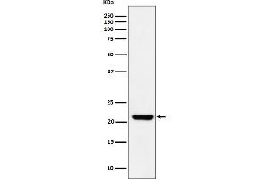 Western blot analysis of ITPA expression in HepG2 cell lysate.