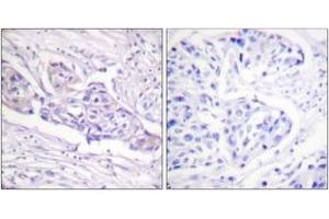 Immunohistochemistry (IHC) image for anti-Forkhead Box O1 (FOXO1) (AA 295-344), (pSer329) antibody (ABIN1531321)