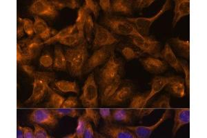 Immunofluorescence analysis of U-2 OS cells using SEPT5 Polyclonal Antibody at dilution of 1:100. (Septin 5 抗体)