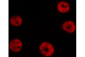 Immunofluorescence (fixed cells) (IF/ICC) image for anti-Signal Transducer and Activator of Transcription 6, Interleukin-4 Induced (STAT6) (pThr645) antibody (ABIN6255720)