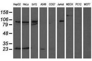 Image no. 2 for anti-Anaphase Promoting Complex Subunit 2 (ANAPC2) antibody (ABIN1496638) (ANAPC2 抗体)