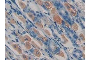 Immunohistochemistry (IHC) image for anti-Spondin 1 (SPON1) (AA 608-802) antibody (ABIN7440035)