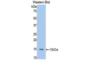 Detection of Recombinant MMP12, Rat using Polyclonal Antibody to Matrix Metalloproteinase 12 (MMP12) (MMP12 抗体  (AA 372-463))