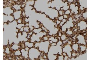 ABIN6265825 and ABIN6276650 at 1/100 staining Mouse lung tissue by IHC-P. (TYR 抗体  (C-Term))