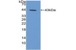 Detection of Recombinant CA9, Human using Polyclonal Antibody to Carbonic Anhydrase IX (CA9) (CA9 抗体  (AA 59-414))
