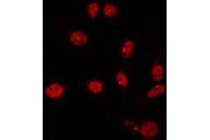 ABIN6266867 staining NIH-3T3 by IF/ICC. (HEXIM1 抗体)
