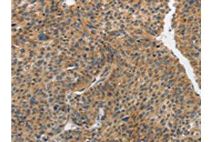 Immunohistochemistry (IHC) image for anti-Phosphatidylinositol-4-Phosphate 5-Kinase, Type I, gamma (PIP5K1C) antibody (ABIN7191891)