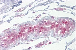 Immunohistochemistry with Breast tissue at an antibody concentration of 5µg/ml using anti-Ehf antibody (ARP36843_P050) (EHF 抗体  (Middle Region))