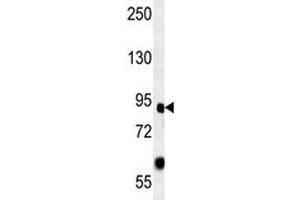 FOXP2 antibody western blot analysis in mouse heart lysate. (FOXP2 抗体  (AA 657-684))