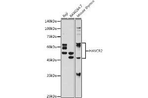 Western blot analysis of extracts of various cell lines, using TIM-3/H antibody (ABIN7267618) at 1:1000 dilution.