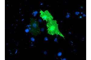 Anti-TULP3 mouse monoclonal antibody (ABIN2455453) immunofluorescent staining of COS7 cells transiently transfected by pCMV6-ENTRY TULP3 (RC207595). (TULP3 抗体)