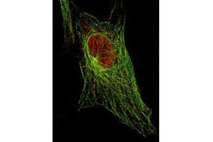 Anti-STAT5 pY694 (MOUSE) Monoclonal Antibody detecting STAT5 in 3T3 cells (immunofluorescent STED microscopy).