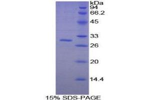 SDS-PAGE (SDS) image for Platelet-Activating Factor Acetylhydrolase 1b, Catalytic Subunit 3 (29kDa) (PAFAH1B3) (AA 1-232) protein (His tag) (ABIN1879345) (PAFAH1B3 Protein (AA 1-232) (His tag))