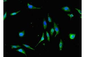 Immunofluorescent analysis of Hela cells using ABIN7175883 at dilution of 1:100 and Alexa Fluor 488-congugated AffiniPure Goat Anti-Rabbit IgG(H+L) (XBP1 抗体  (AA 1-167))