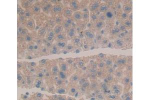 Used in DAB staining on fromalin fixed paraffin- embedded Kidney tissue (HLTF 抗体  (AA 831-990))