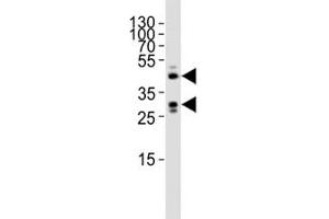 Western Blotting (WB) image for anti-Sirtuin 3 (SIRT3) (AA 304-334) antibody (ABIN3032591)