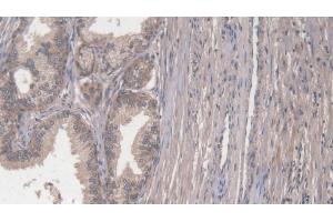 Immunohistochemistry (IHC) image for anti-Collagen, Type I, alpha 2 (COL1A2) (AA 1103-1366) antibody (ABIN7431329)