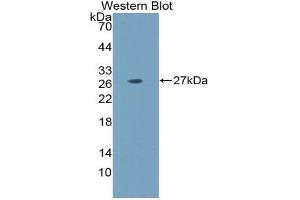 Detection of Recombinant LAMa5, Mouse using Polyclonal Antibody to Laminin Alpha 5 (LAMa5) (Laminin alpha 5 抗体  (AA 3517-3718))