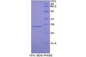 SDS-PAGE analysis of Mouse FDFT1 Protein. (FDFT1 蛋白)