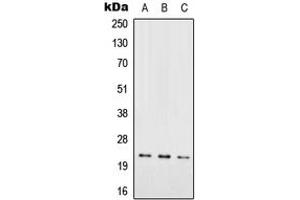 Western blot analysis of RAB7L1 expression in HEK293T (A), SP2/0 (B), PC12 (C) whole cell lysates. (RAB7L1 抗体  (Center))