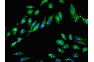Immunofluorescent analysis of Hela cells using ABIN7161958 at dilution of 1:100 and Alexa Fluor 488-congugated AffiniPure Goat Anti-Rabbit IgG(H+L) (GTPBP4 抗体  (AA 347-634))