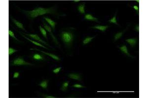 Immunofluorescence of monoclonal antibody to ZNF274 on HeLa cell. (ZNF274 抗体  (AA 420-530))