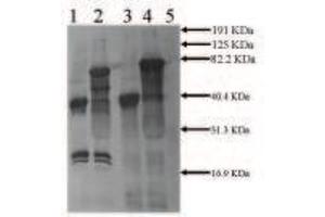 Rabbit anti Mouse tPA (2ug/ml) Secondary:  anti Rabbit IgG ABC Kit Lane 1:  0. (PLAT 抗体)