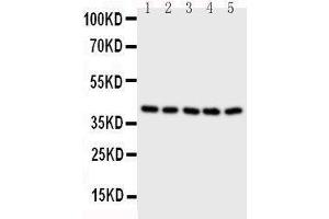 Western Blotting (WB) image for anti-Branched Chain Amino-Acid Transaminase 2, Mitochondrial (BCAT2) (AA 377-392), (C-Term) antibody (ABIN3043181) (BCAT2 抗体  (C-Term))