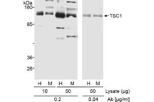 Western Blotting (WB) image for anti-Tuberous Sclerosis 1 (TSC1) (C-Term) antibody (ABIN7449615)