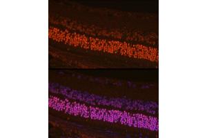 Immunofluorescence analysis of mouse retina cells using CRX Rabbit pAb (ABIN6130142, ABIN6139059, ABIN6139060 and ABIN6221382) at dilution of 1:200 (40x lens). (CRX 抗体  (AA 120-285))