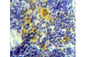 Used in DAB staining on fromalin fixed paraffin-embedded Spleen tissue (IL-15 抗体  (AA 48-162))