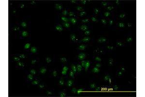 Immunofluorescence of purified MaxPab antibody to NOP56 on HeLa cell. (NOP56 抗体  (AA 49-174))