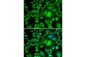 Immunofluorescence analysis of A-549 cells using CBR1 antibody. (CBR1 抗体  (AA 1-277))