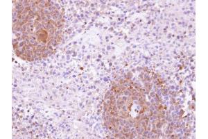 IHC-P Image Immunohistochemical analysis of paraffin-embedded SAS xenograft, using KHS, antibody at 1:100 dilution. (MAP4K5 抗体)