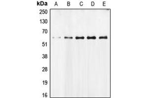 Western blot analysis of AIFM1 expression in MCF7 (A), Molt (B), Jurkat (C), mouse liver (D), rat heart (E) whole cell lysates. (AIF 抗体  (N-Term))
