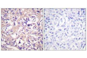 Immunohistochemistry (IHC) image for anti-TK (N-Term), (Ser13) antibody (ABIN1847976) (TK (N-Term), (Ser13) 抗体)
