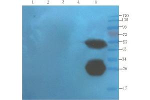 Western Blot using anti-TNF alpha antibody  Mouse liver (lane 1), mouse spinal cord (lane 2), mouse testis (lane 3), mouse colon (lane 4) and human thyroid tumour (lane 5) samples were resolved on a 10% SDS PAGE gel and blots probed with  at 1. (Recombinant TNF alpha (Infliximab Biosimilar) 抗体)