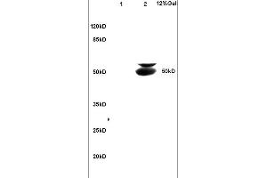 Lane 1: mouse brain lysates Lane 2: mouse intestine lysates probed with Anti BECN1/Beclin 1/ATG6 Polyclonal Antibody, Unconjugated (ABIN675384) at 1:200 in 4C. (Beclin 1 抗体  (AA 201-330))