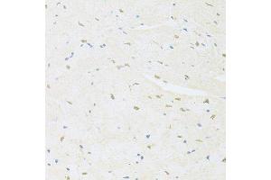 Immunohistochemistry (Paraffin-embedded Sections) (IHC (p)) image for anti-Scaffold Attachment Factor B (SAFB) (AA 1-200) antibody (ABIN6147357)