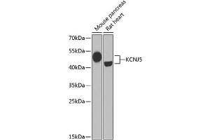 Western blot analysis of extracts of various cell lines, using KCNJ5 Antibody (ABIN6134098, ABIN6142740, ABIN6142741 and ABIN6221828) at 1:1000 dilution. (KCNJ5 抗体  (AA 50-150))