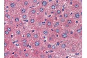 Mouse Liver (formalin-fixed, paraffin-embedded) stained with TSLPfollowed by biotinylated goat anti-rabbit IgG secondary antibody, alkaline phosphatase-streptavidin and chromogen. (Thymic Stromal Lymphopoietin 抗体)